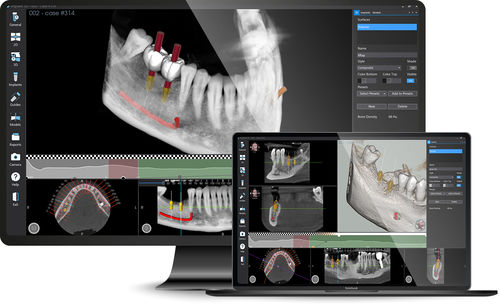 医用设计软件 - Implant 3D - MediaLab - 3D 模拟 / 检查用 / 医用