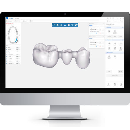 医用设计软件 - DESIGN+ - DDS Inc - CAD / 临床 / 牙科