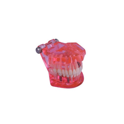 牙龈解剖模型 - #A26 - CavoMed / 3D Dental - 假牙 / 根管 / 牙科疾病
