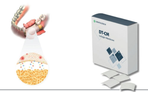 牙科手术组织膜 - DT-CM - DENTAL TECH S.R.L. - 胶原蛋白 / 可吸收