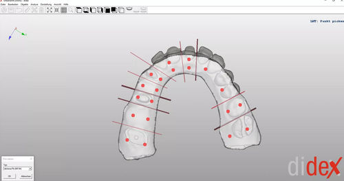 捕获软件 - didex  - Dentona AG - 3D 打印 / 模型制作 / 生产
