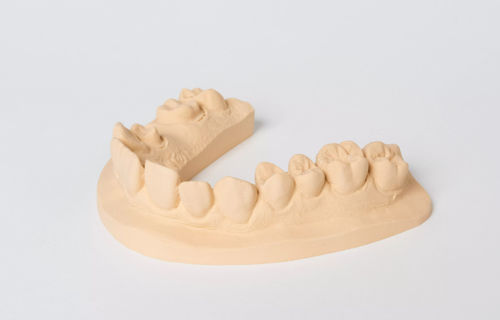 石材牙科材料 - esthetic-base® evolution - Dentona AG - 牙科实验室 / 模型制作