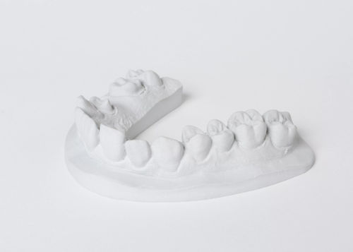 石材牙科材料 - esthetic-rock® 285 - Dentona AG - 模型制作