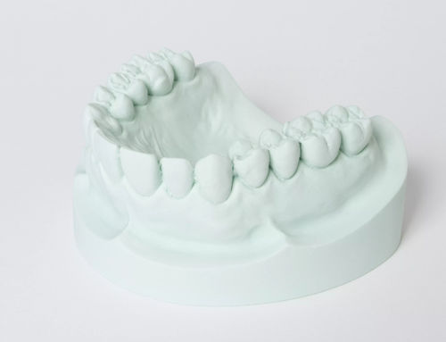 石膏牙科材料 - hydro-stone® 200 - Dentona AG - 石材 / 流动式 / 模型制作