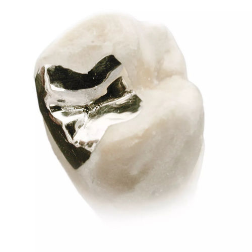 石膏牙科材料 - precibalite® plus  - Dentona AG - 用于种植体基台 / 用于牙冠 / 用于牙嵌