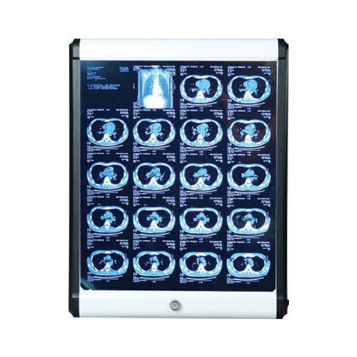 单联式X光片观片灯 - SSMEC-VB-100 - Samsung Medi Engineering