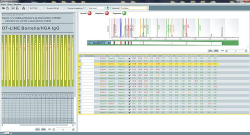 分析软件 - SwIm03 - TestLine Clinical Diagnostics - 医用 / 实验室 / 用于免疫印迹