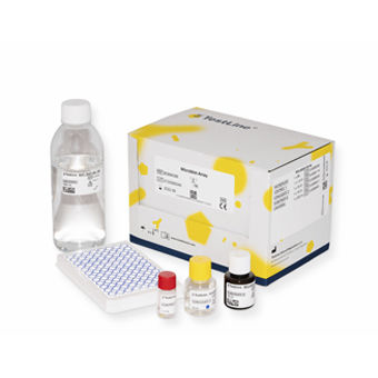 IgG免疫球蛋白G快速诊断套装 - CMGMA48 - TestLine Clinical Diagnostics - CMV / 血清 / 等离子
