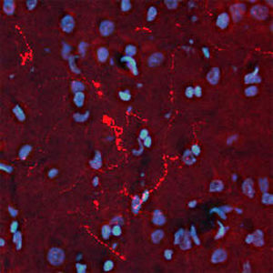 乙型内啡肽试剂 - RA21004 - Neuromics - 多克隆抗体 / IgG / 用于科研