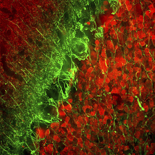 Α-交联蛋白试剂 - MO22154 - Neuromics - 单克隆抗体 / IgG / 用于科研
