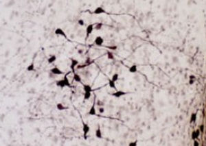 催产素试剂 - RA24604 - Neuromics - 抗体 / 血清 / 用于免疫组织化学