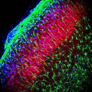 IgG试剂 - RA25034 - Neuromics - 蛋白质印迹 / 用于免疫组织化学 / 液体