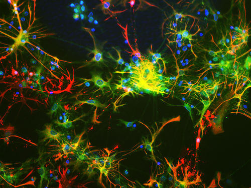 单克隆抗体试剂 - MO22143 - Neuromics - 用于科研 / 蛋白质印迹 / 用于免疫组织化学