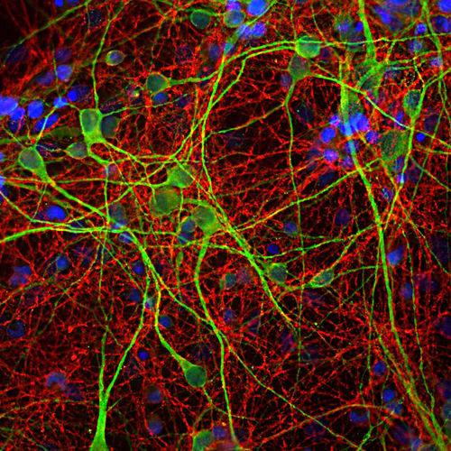 抗体试剂 - MO22170 - Neuromics - 用于科研 / 蛋白质印迹 / 用于免疫组织化学