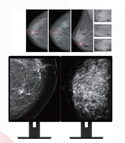 医用显示器 - MC50A - ZRT Technology - 诊断 / 乳腺造影 / 21.3"