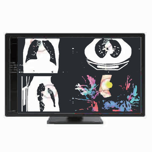 医用显示器 - MC80A - ZRT Technology - 诊断 / 3840 × 2160 / 31.5"