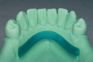蜡牙科材料 - WaxStar - scheftner dental - 牙齿修复