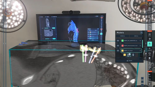 医学成像人工智能平台 - SurgicalAR® - MEDIVIS - 术前统筹 / 培训 / 3D 打印