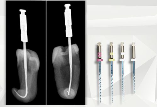 旋转牙科锉刀 - croot0003 - C-Root Dental Medical - 用于根管治疗 / NiTi