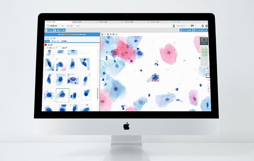 医学研究人工智能平台 - CYTOPROCESSOR® - DATEXIM - 实验室 / 子宫颈癌症检出 / 基于网络