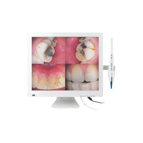 口腔内摄像机 - M-978V - Chuan Fu Medical Instrument Co., Ltd. - 数字 / CMOS