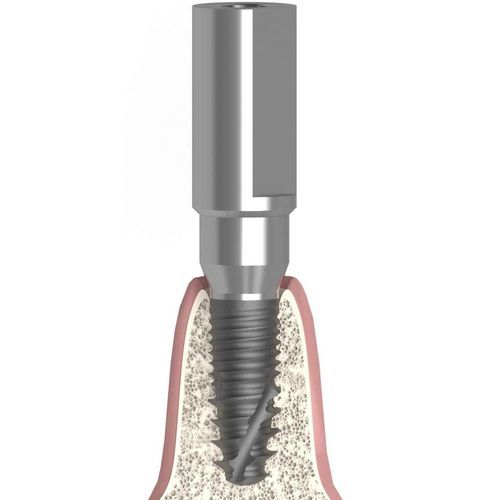 口腔内口腔内部扫描器 - UNIFORM SIC® ace® max® - Bionika Medline Kft. - 金属