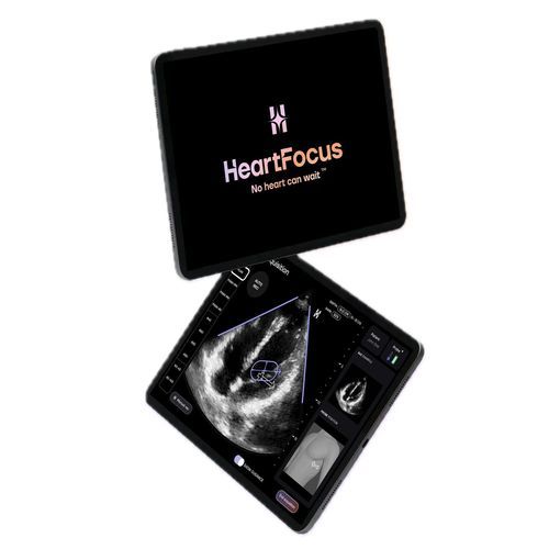 超声心动图检查移动应用 - HeartFocus - DESKI - 诊断 / 报告 / 监护