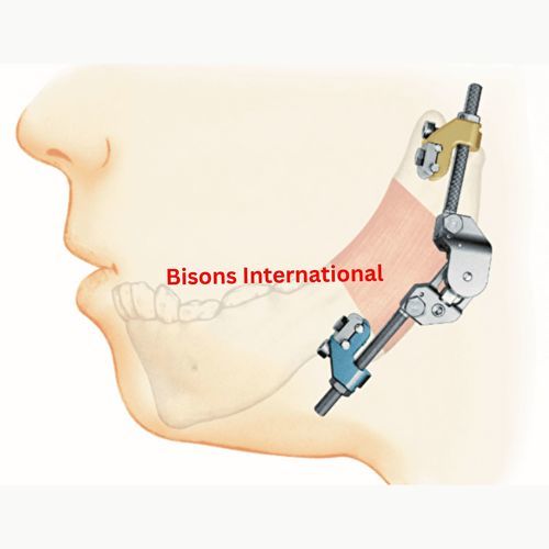 颌骨牵张器 - BI-001477 - Bisons International - 颅骨 / 外部