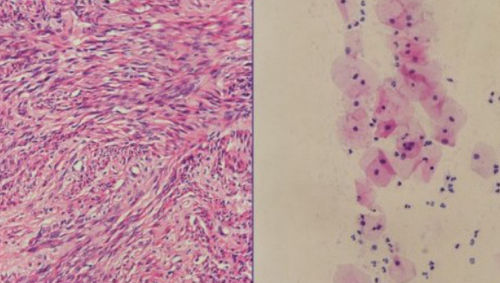 哈里斯血红素试剂套装 - H-E stain - Wuhan Jinhong Biotech Development Co., Ltd. - 组织病理学