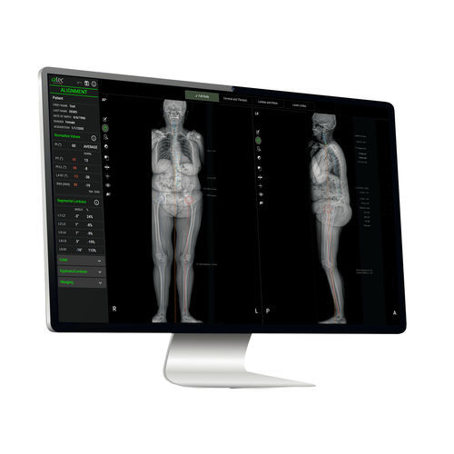 医疗人工智能平台 - EOS IMAGING - 医学成像 / 用于量化 / 机器学习