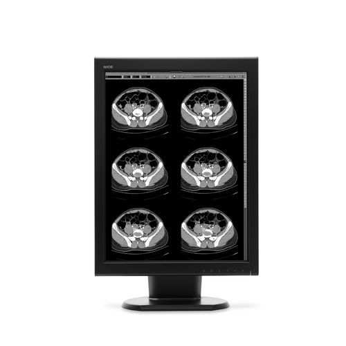 诊断显示器 - MX20N - Wide USA Corporation - 医学成像 / 21.3" / 液晶
