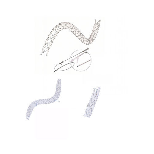 输尿管支架 - EUS0919514 - Hunan Endovascular Device Co., Ltd. - 镍钛合金 / 保护层