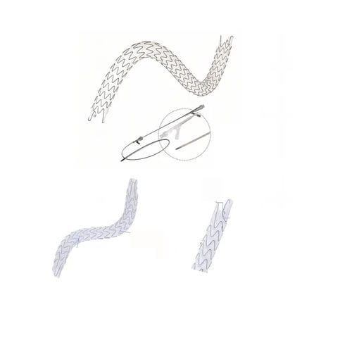 输尿管支架 - EUS series - Hunan Endovascular Device Co., Ltd. - 镍钛合金 / 聚合物 / 自膨胀式