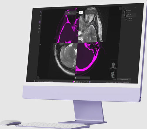 医用软件 - zap-axon - ZAP Surgical Systems Inc - 设计 / 加工 / 规划