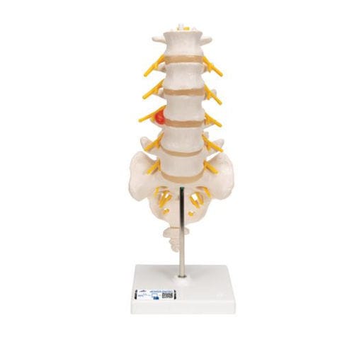 腰脊柱解剖模型 - A76/5 - 3B Scientific  /德国3B Scientific - 骶骨 / 教学