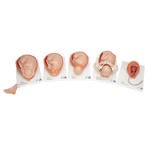 子宫解剖模型 - VG392 - 3B Scientific  /德国3B Scientific - 教学 / 女性