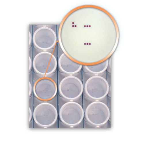 传染病快速诊断套装 - DA4270 - AID , Autoimmun Diagnostika   - HPV / 人乳头状瘤病毒 / 咽拭子