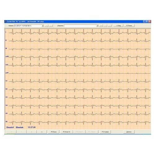 心电图机软件 - CARDIOTEKA v.211SOFTHL7 - ASPEL  - 查看 / 心脏 / 在线