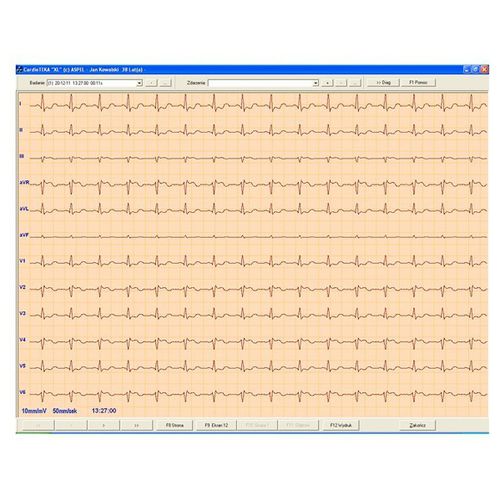 心电图机软件 - CARDIOTEKA v.211SOFT - ASPEL  - 诊断 / 监护 / 心脏