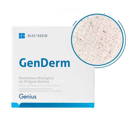 牙科手术组织基质 - GenDerm - BAUMER  - 异种移植 / 透明