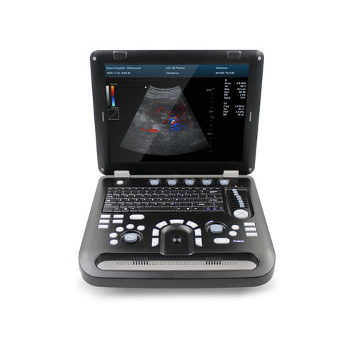 便携式B超机 - CMS1700C  - Contec Medical Systems - 妇产科用超声成像 / 腹腔和盆腔超声成像 / 彩色多普勒