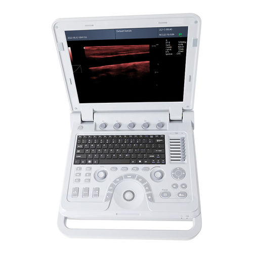 便携式B超机 - CMS600P2PLUS - Contec Medical Systems - 妇产科用超声成像 / 腹腔和盆腔超声成像 / 用于泌尿科超声检查