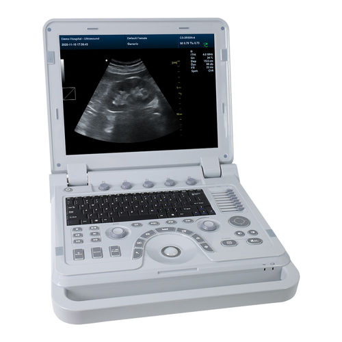 兽医超声波检查仪 / 便携式 - CMS1700A-VET - Contec Medical Systems - 多功能 / 黑白 / 彩色多普勒
