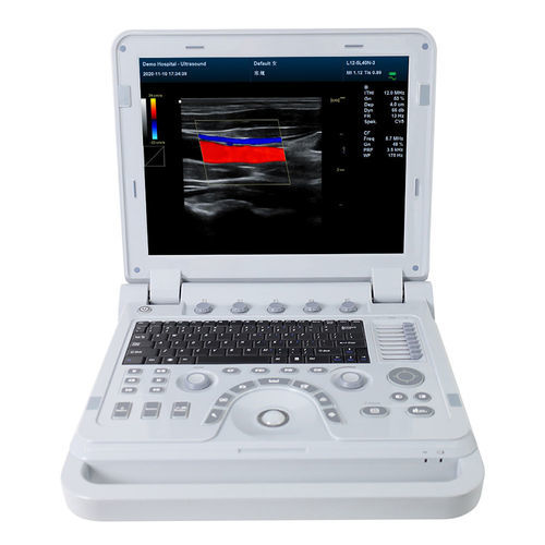 便携式B超机 - CMS1700A  - Contec Medical Systems - 用于多功能超声检查 / 妇产科用超声成像 / 腹腔和盆腔超声成像