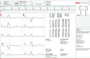 诊断算法 - ECG algorithms - Corscience GmbH & Co. KG - 分析 / 带心电图