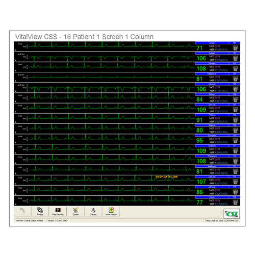 病人中央监护工作站 - VitalView® CSS - Criticare Systems - 16 张床