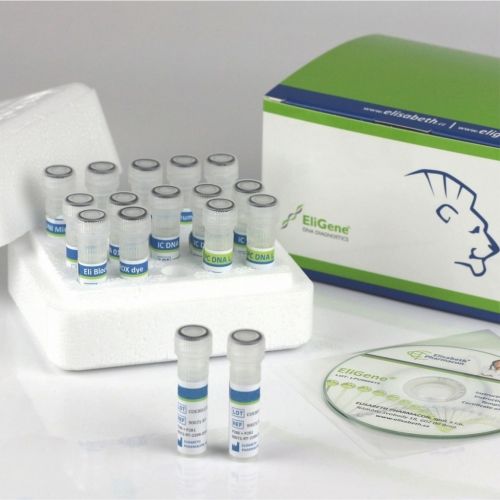 COVID-19新冠病毒快速诊断套装 - 90078-RT - Elisabeth Pharmacon spol  - SARS-COV-2 / 临床 / 血清