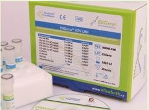 脑炎快速诊断套装 - EliGene® TBEV LC  - Elisabeth Pharmacon spol  - 用于研究 / 用于病毒 / 临床