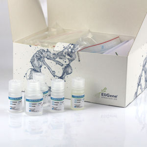 溶液试剂套装 - EliGene® - Elisabeth Pharmacon spol  - 临床 / 用于唾液样本 / DNA提取