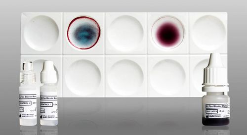 单核细胞增多症快速诊断检测 - ELITex Bicolor Mono - ELITech Group  - 抗体 / 埃-巴二氏病毒 / 血液